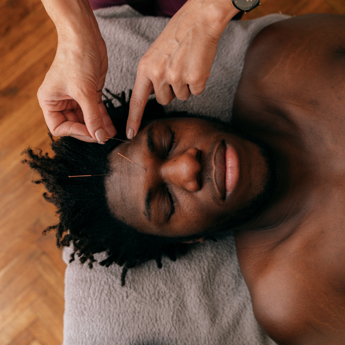 acupuncture in IN SOUTH JORDAN (1)